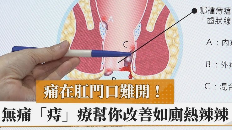 莱奥训练意外打滑致腹股沟拉伤